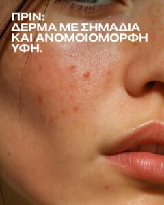 Δερματολόγος Ρόδος, αφροδισιολόγος Ρόδος, δερματοσκόπηση Ρόδος, κρυοθεραπεία Ρόδος, laser αποτρίχωση Ρόδος, αφαίρεση τατουάζ Ρόδος, ενέσιμη μεσοθεραπεία Ρόδος, φωτοανάπλαση Ρόδος, Χιώτης 