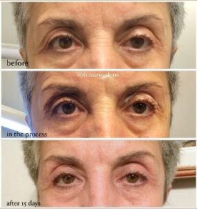 Δερματολόγος Θεσσαλονίκη, αφροδισιολόγος Θεσσαλονίκη, botox Θεσσαλονίκη, laser αλεξανδρίτης Θεσσαλονίκη, lifting Θεσσαλονίκη, μεσοθεραπεία Θεσσαλονίκη, υαλουρονικό χειλιών Θεσσαλονίκη, Ιωσηφίδου