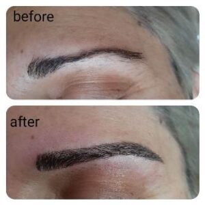 Κέντρο αισθητικής Πτολεμαΐδα, αποτρίχωση laser Πτολεμαΐδα, καθαρισμός προσώπου Πτολεμαΐδα, θεραπεία αντιγήρανσης Πτολεμαΐδα, μεσοθεραπεία Πτολεμαΐδα, θεραπείες αδυνατίσματος Πτολεμαΐδα, Aesthetic