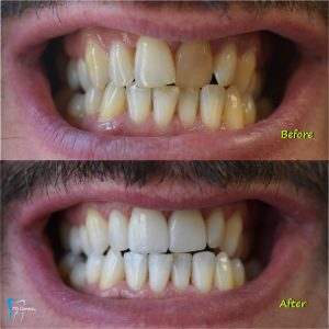 Οδοντίατρος Βόλος, χειρουργός οδοντίατρος Βόλος, καθάρισμα δοντιών Βόλος, λεύκανση δοντιών Βόλος, εξαγωγή δοντιού Βόλος, απονευρώσεις δοντιών Βόλος, σφράγισμα δοντιών Βόλος, Μαστορίδης