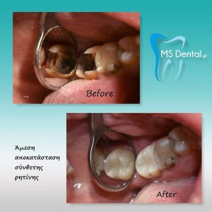 Οδοντίατρος Βόλος, χειρουργός οδοντίατρος Βόλος, καθάρισμα δοντιών Βόλος, λεύκανση δοντιών Βόλος, εξαγωγή δοντιού Βόλος, απονευρώσεις δοντιών Βόλος, σφράγισμα δοντιών Βόλος, Μαστορίδης