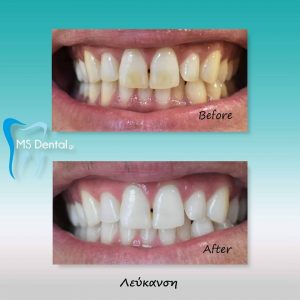 Οδοντίατρος Βόλος, χειρουργός οδοντίατρος Βόλος, καθάρισμα δοντιών Βόλος, λεύκανση δοντιών Βόλος, εξαγωγή δοντιού Βόλος, απονευρώσεις δοντιών Βόλος, σφράγισμα δοντιών Βόλος, Μαστορίδης