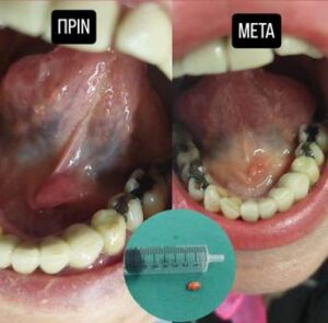 Ωτορινολαρυγγολόγος Ιωάννινα, ωριλά Ιωάννινα, ΩΡΛ Ιωάννινα, ωτομικροσκόπηση Ιωάννινα, ακουόγραμμα Ιωάννινα, ρινοσκόπηση Ιωάννινα, εξέταση λαβύρινθου Ιωάννινα, λαρυγγοσκόπηση Ιωάννινα, μέτρηση όσφρησης Ιωάννινα, Ζαράχη 