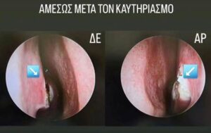 Ωτορινολαρυγγολόγος Ιωάννινα, ωριλά Ιωάννινα, ΩΡΛ Ιωάννινα, ωτομικροσκόπηση Ιωάννινα, ακουόγραμμα Ιωάννινα, ρινοσκόπηση Ιωάννινα, εξέταση λαβύρινθου Ιωάννινα, λαρυγγοσκόπηση Ιωάννινα, μέτρηση όσφρησης Ιωάννινα, Ζαράχη 