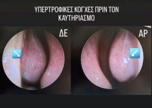 Ωτορινολαρυγγολόγος Ιωάννινα, ωριλά Ιωάννινα, ΩΡΛ Ιωάννινα, ωτομικροσκόπηση Ιωάννινα, ακουόγραμμα Ιωάννινα, ρινοσκόπηση Ιωάννινα, εξέταση λαβύρινθου Ιωάννινα, λαρυγγοσκόπηση Ιωάννινα, μέτρηση όσφρησης Ιωάννινα, Ζαράχη 