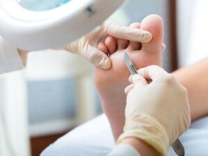 Ποδολόγος Γλυφάδα, μυκητιάσεις Γλυφάδα, αθλητικό πόδι Γλυφάδα, εκπύρωση κάλων Γλυφάδα, προσθετική νυχιών Γλυφάδα, θεραπευτικό πεντικιούρ Γλυφάδα, σκληρύνσεις ποδιών Γλυφάδα, υπερκερατώσεις ποδιών Γλυφάδα, Αμπαζά 