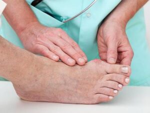 Ποδολόγος Γλυφάδα, μυκητιάσεις Γλυφάδα, αθλητικό πόδι Γλυφάδα, εκπύρωση κάλων Γλυφάδα, προσθετική νυχιών Γλυφάδα, θεραπευτικό πεντικιούρ Γλυφάδα, σκληρύνσεις ποδιών Γλυφάδα, υπερκερατώσεις ποδιών Γλυφάδα, Αμπαζά 