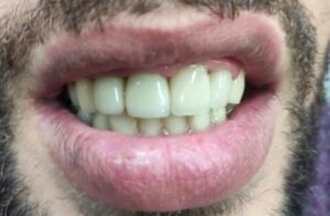 Χειρουργός οδοντίατρος Αιγάλεω, οδοντιατρείο Αιγάλεω, εφαρμογές laser Αιγάλεω, λεύκανση δοντιών Αιγάλεω, εξαγωγή δοντιών Αιγάλεω, απονευρώσεις δοντιών Αιγάλεω, σφράγισμα δοντιών Αιγάλεω, Μυτιληναίος