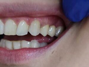 Χειρουργός οδοντίατρος Αιγάλεω, οδοντιατρείο Αιγάλεω, εφαρμογές laser Αιγάλεω, λεύκανση δοντιών Αιγάλεω, εξαγωγή δοντιών Αιγάλεω, απονευρώσεις δοντιών Αιγάλεω, σφράγισμα δοντιών Αιγάλεω, Μυτιληναίος