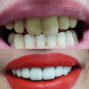 Χειρουργός οδοντίατρος Λαμία, οδοντιατρείο Λαμία, εξαγωγή δοντιών Λαμία, απονεύρωση δοντιών Λαμία, καθαρισμός δοντιών Λαμία, σφράγισμα δοντιών Λαμία, Σκιαδοπούλου