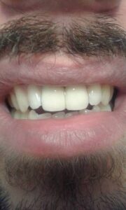 Χειρουργός οδοντίατρος Λαμία, οδοντιατρείο Λαμία, εξαγωγή δοντιών Λαμία, απονεύρωση δοντιών Λαμία, καθαρισμός δοντιών Λαμία, σφράγισμα δοντιών Λαμία, Σκιαδοπούλου