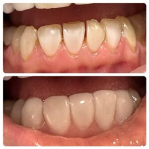 Χειρουργός Οδοντίατρος Πύργος, οδοντιατρείο Πύργος, εξαγωγή δοντιών Πύργος, απονευρώσεις δοντιών Πύργος, καθαρισμός δοντιών Πύργος, όψεις ρητίνης Πύργος, λεύκανση δοντιών Πύργος, σφράγισμα δοντιών Πύργος, Παρνασσά 