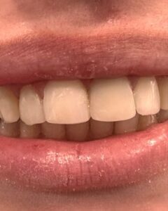 Χειρουργός Οδοντίατρος Πύργος, οδοντιατρείο Πύργος, εξαγωγή δοντιών Πύργος, απονευρώσεις δοντιών Πύργος, καθαρισμός δοντιών Πύργος, όψεις ρητίνης Πύργος, λεύκανση δοντιών Πύργος, σφράγισμα δοντιών Πύργος, Παρνασσά 