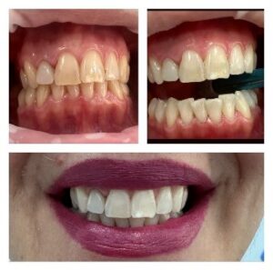 Χειρουργός Οδοντίατρος Πύργος, οδοντιατρείο Πύργος, εξαγωγή δοντιών Πύργος, απονευρώσεις δοντιών Πύργος, καθαρισμός δοντιών Πύργος, όψεις ρητίνης Πύργος, λεύκανση δοντιών Πύργος, σφράγισμα δοντιών Πύργος, Παρνασσά 