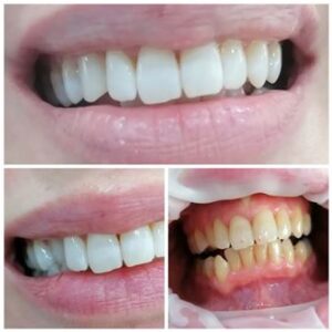 Χειρουργός Οδοντίατρος Πύργος, οδοντιατρείο Πύργος, εξαγωγή δοντιών Πύργος, απονευρώσεις δοντιών Πύργος, καθαρισμός δοντιών Πύργος, όψεις ρητίνης Πύργος, λεύκανση δοντιών Πύργος, σφράγισμα δοντιών Πύργος, Παρνασσά 