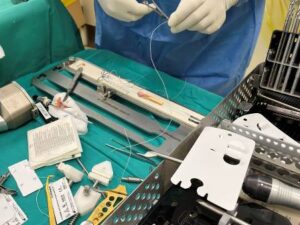 Χειρουργός ορθοπεδικός Βόλος, αθλητικές κακώσεις Βόλος, αρθροσκοπήσεις Βόλος, αρθροπλαστικές Βόλος, αντιμετώπιση καταγμάτων Βόλος, οστεοπόρωση Βόλος, Αγραφιώτης 